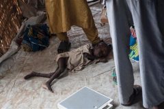 UNICEF says some 49,000 children will die of malnutrition in Nigeria