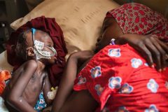 Nigeria: Donations needed to avert death of 75,000 starving kids